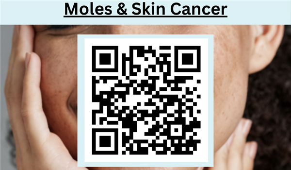 moles and skin cancer
